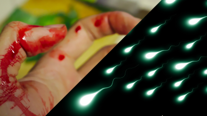 HIV Übertragung