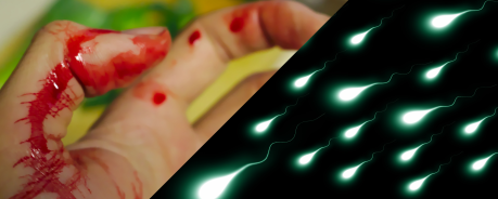 HIV Übertragung HIV Übertragung