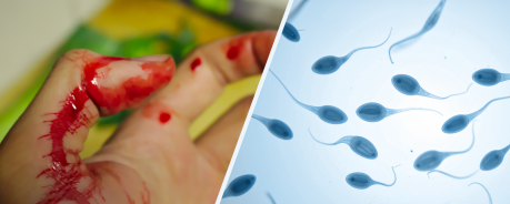 Seitengrafik-HIV Übertragung - Titelbild